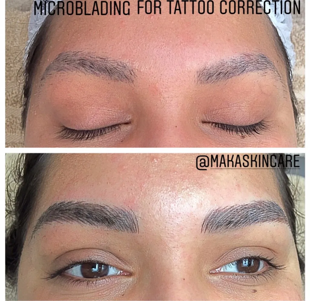 MAKASkincare - Aesthetics Clinic
