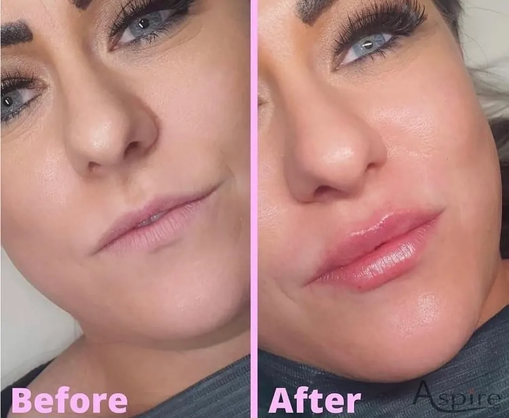 Aspire Aesthetics UK - Ilford