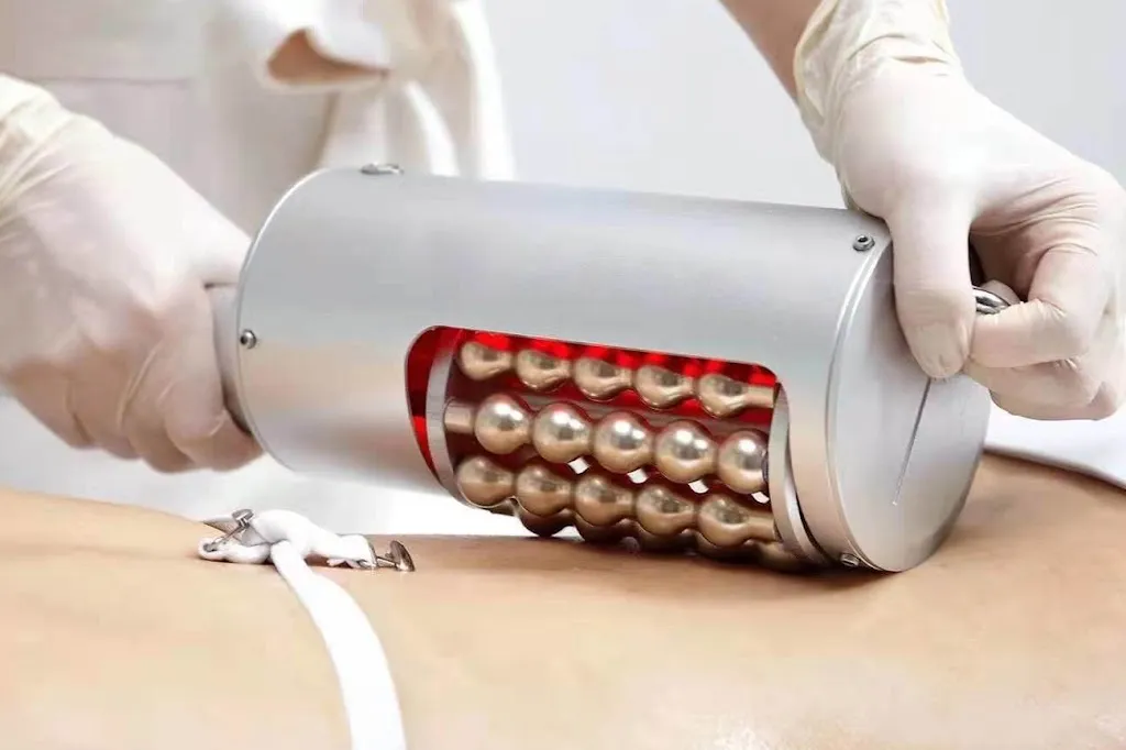 Beauty Magic London | Endosphere and LPG Hammersmith