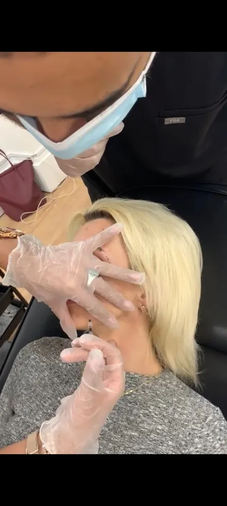 Flaw-less face and fillers west London