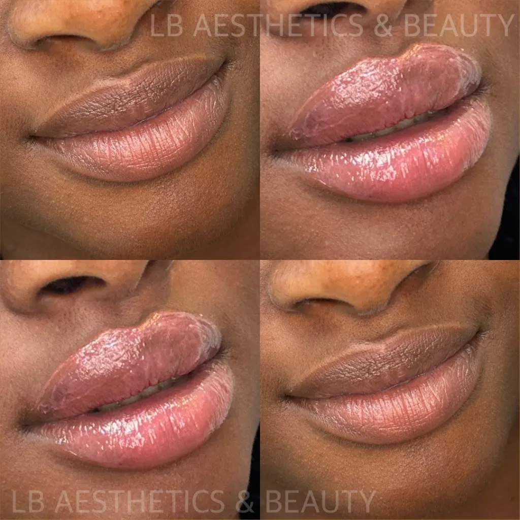 LB Aesthetics & Beauty Ltd