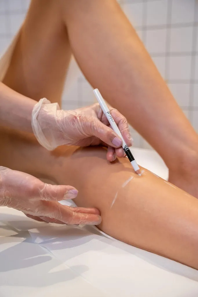 Strip Hair Removal Experts- Notting Hill