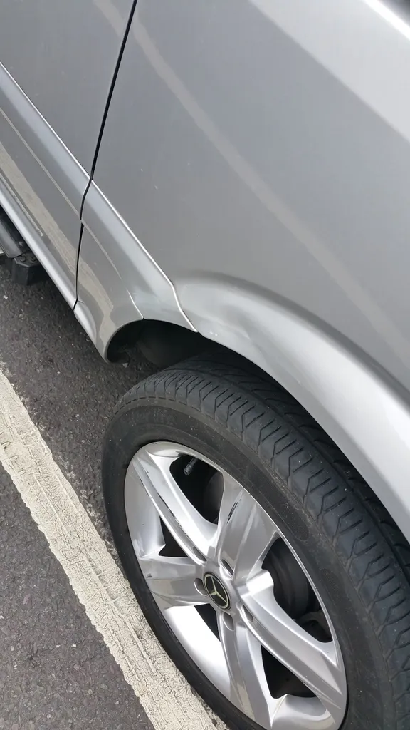 Dent Man