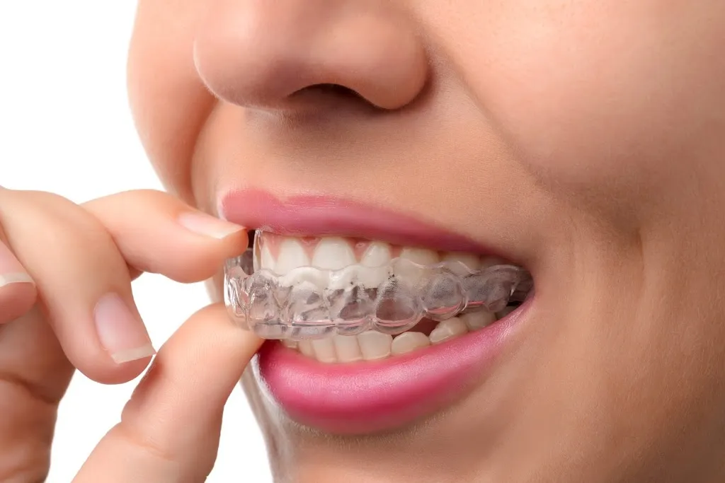 Advance Dental Care - Accepting New Patients | Invisalign | Dental Implants | Facial Aesthetics | Hygienists