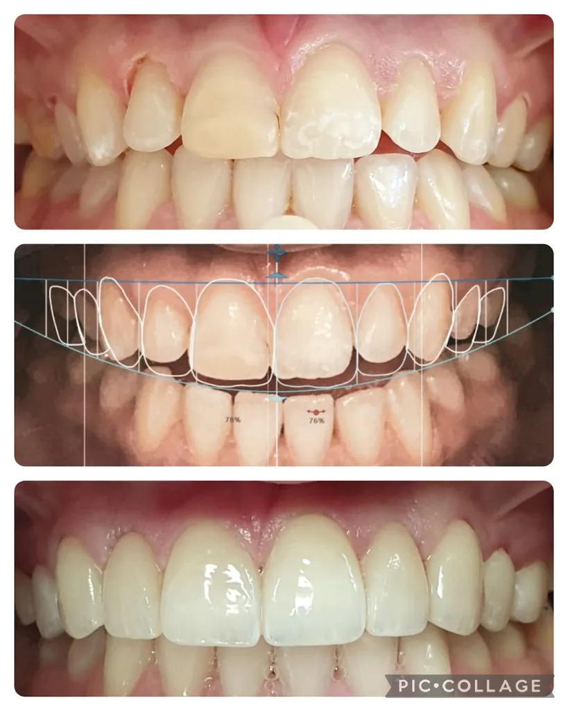 Angel Smile Dental Care