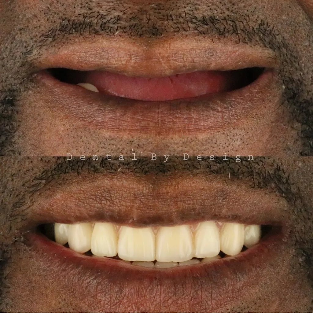 Dental By Design