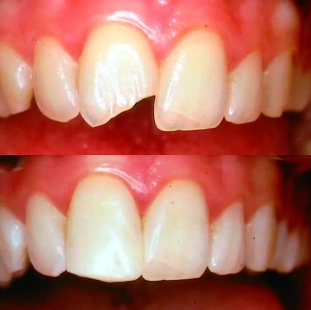 Family Dental Care 1 Family Dental Care