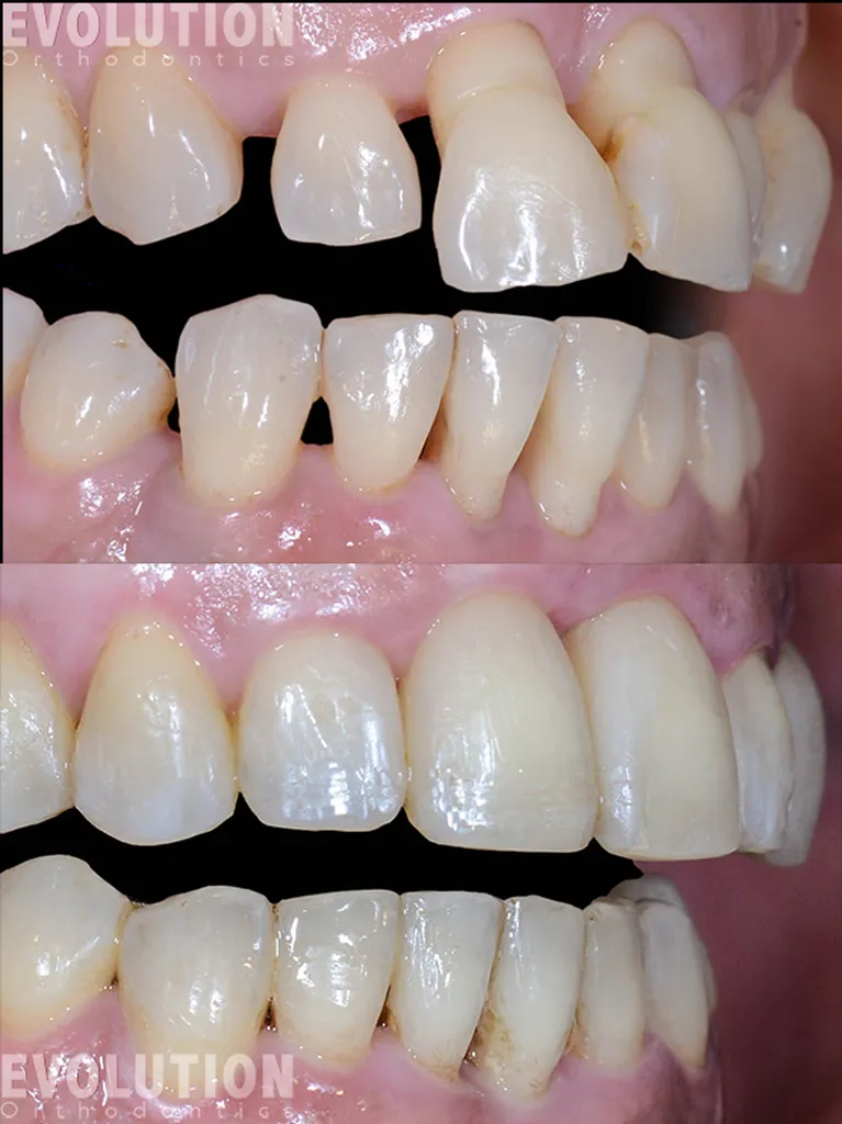 FIRST Ortho - First Impressions