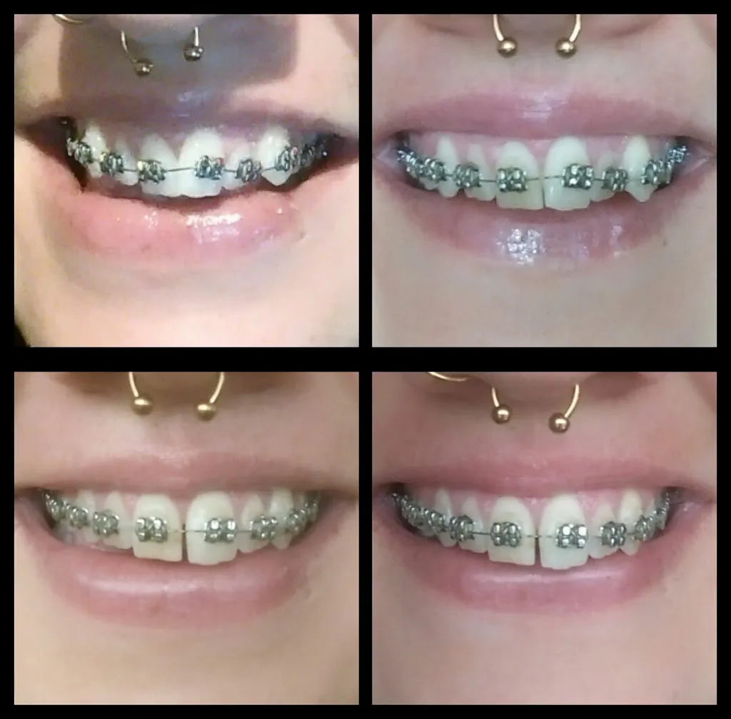 iDental