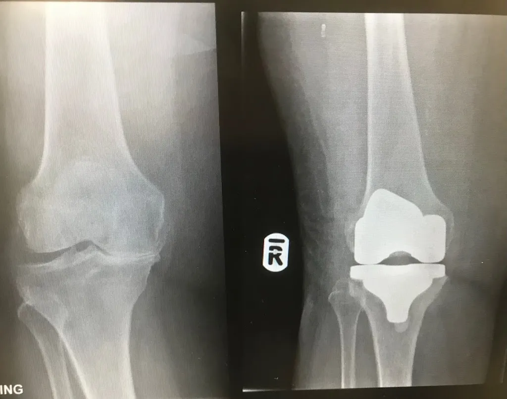 Mr Shah Punwar - Expert Hip and Knee Orthopaedic Surgeon