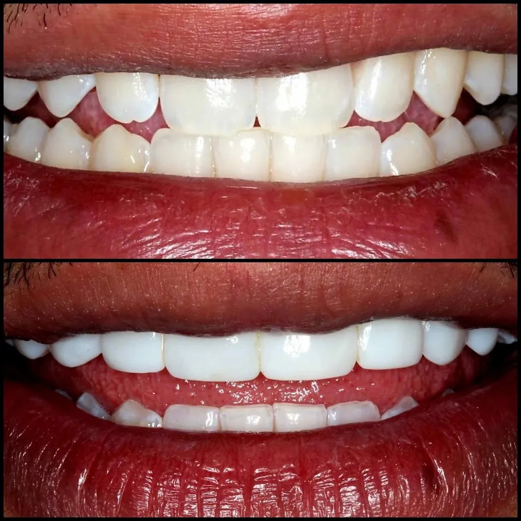 Predent Dental Clinic
