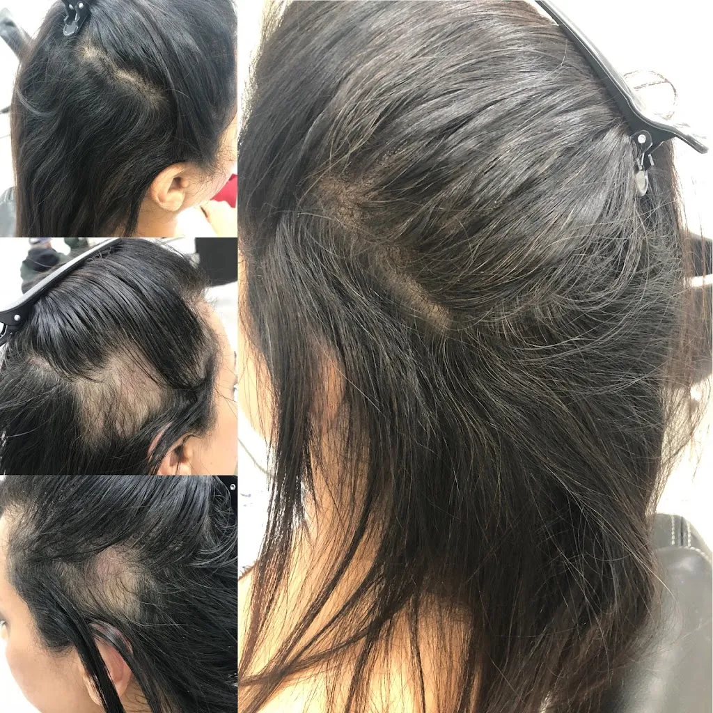 EsteHair Medical- Hair & Skin Clinic Harrow London