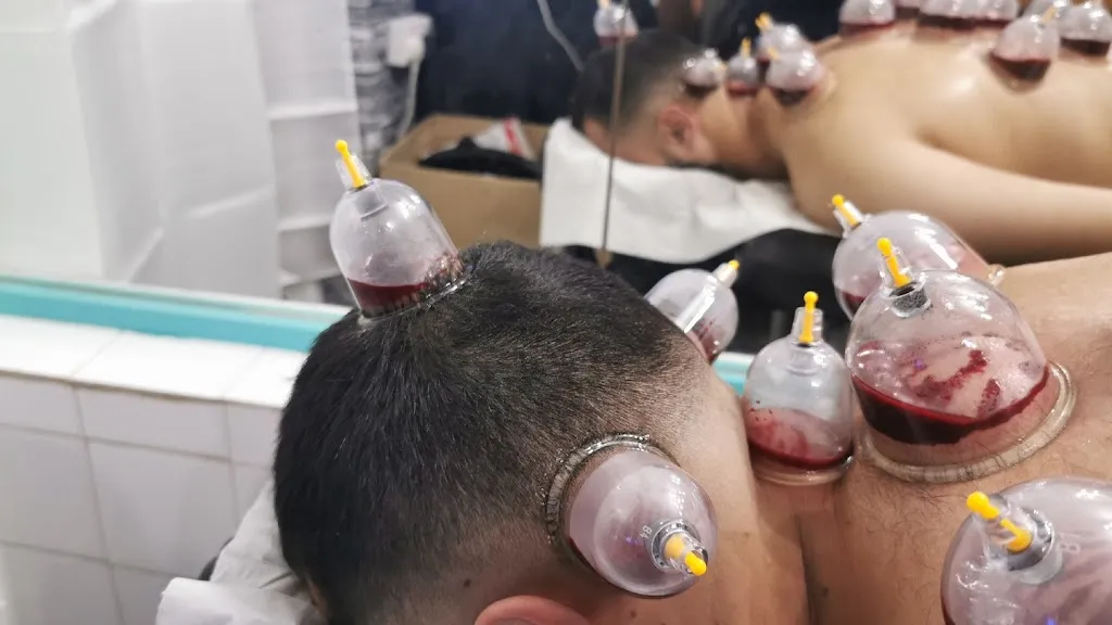 RUQYAH HIJAMA SERVICES